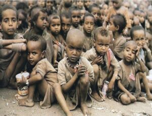 malnutrition malnutrition